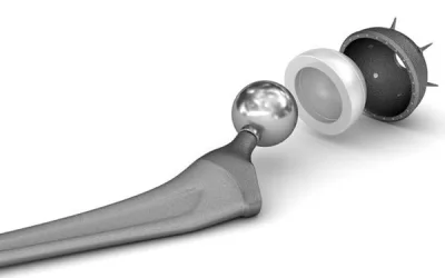 The New Era of Personalized Medicine: How Low Volume Manufacturing is Revolutionizing Patient Care