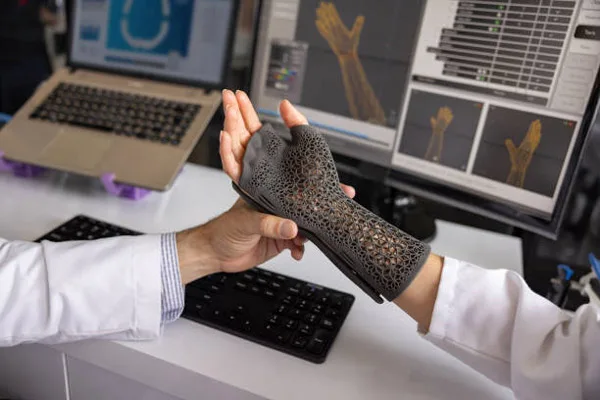 3D prosthetics